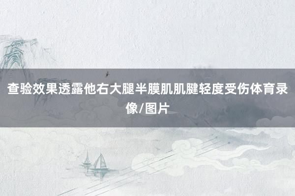 查验效果透露他右大腿半膜肌肌腱轻度受伤体育录像/图片